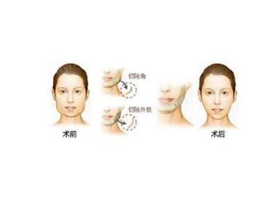 廣西醫科大學附屬第一醫院整形科,專家坐診時間